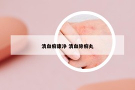 清血癣康净 清血除癣丸