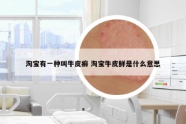 淘宝有一种叫牛皮癣 淘宝牛皮鲜是什么意思