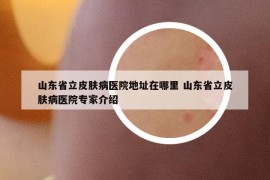 山东省立皮肤病医院地址在哪里 山东省立皮肤病医院专家介绍