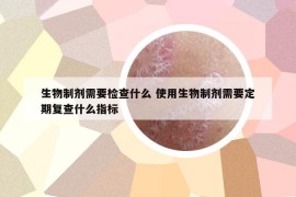 生物制剂需要检查什么 使用生物制剂需要定期复查什么指标