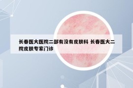 长春医大医院二部有没有皮肤科 长春医大二院皮肤专家门诊