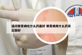 请问银霄病吃什么药最好 银霄病用什么药膏比较好