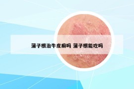 蒲子根治牛皮癣吗 蒲子根能吃吗