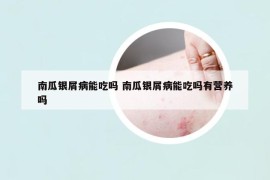 南瓜银屑病能吃吗 南瓜银屑病能吃吗有营养吗