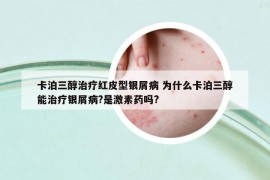 卡泊三醇治疗红皮型银屑病 为什么卡泊三醇能治疗银屑病?是激素药吗?