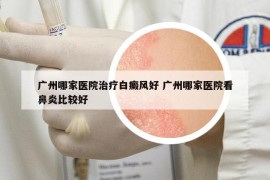 广州哪家医院治疗白癜风好 广州哪家医院看鼻炎比较好