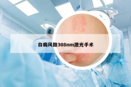 白癜风做308nm激光手术