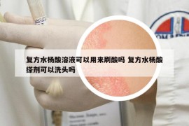 复方水杨酸溶液可以用来刷酸吗 复方水杨酸搽剂可以洗头吗