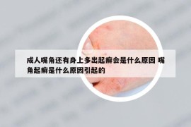 成人嘴角还有身上多出起癣会是什么原因 嘴角起癣是什么原因引起的