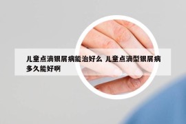 儿童点滴银屑病能治好么 儿童点滴型银屑病多久能好啊