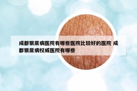 成都银屑病医院有哪些医院比较好的医院 成都银屑病权威医院有哪些