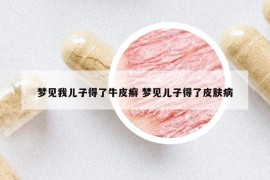 梦见我儿子得了牛皮癣 梦见儿子得了皮肤病