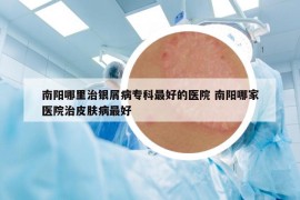 南阳哪里治银屑病专科最好的医院 南阳哪家医院治皮肤病最好