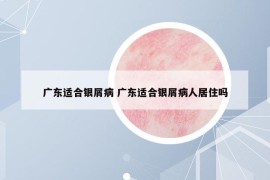 广东适合银屑病 广东适合银屑病人居住吗