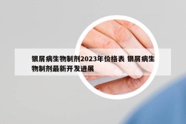 银屑病生物制剂2023年价格表 银屑病生物制剂最新开发进展