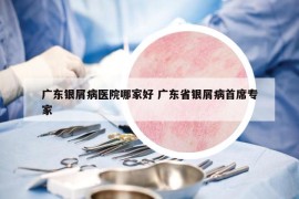 广东银屑病医院哪家好 广东省银屑病首席专家