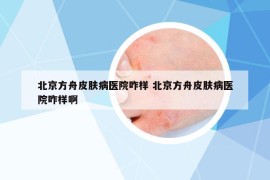 北京方舟皮肤病医院咋样 北京方舟皮肤病医院咋样啊