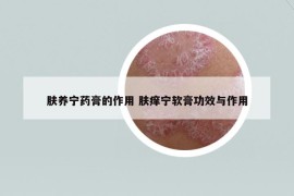 肤养宁药膏的作用 肤痒宁软膏功效与作用