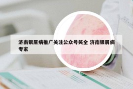 济南银屑病推广关注公众号笑全 济南银屑病专家