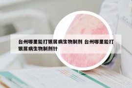 台州哪里能打银屑病生物制剂 台州哪里能打银屑病生物制剂针