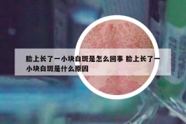 脸上长了一小块白斑是怎么回事 脸上长了一小块白斑是什么原因