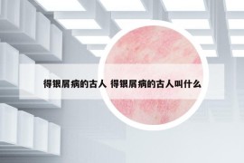 得银屑病的古人 得银屑病的古人叫什么