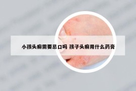 小孩头癣需要忌口吗 孩子头癣用什么药膏