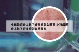 小孩最近身上长了好多癣怎么回事 小孩最近身上长了好多癣怎么回事儿