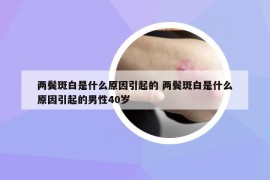 两鬓斑白是什么原因引起的 两鬓斑白是什么原因引起的男性40岁