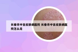 长春市中吉皮肤病医院 长春市中吉皮肤病医院怎么走