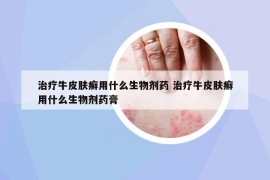 治疗牛皮肤癣用什么生物剂药 治疗牛皮肤癣用什么生物剂药膏