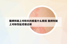 胳膊和腿上对称长的癣是什么原因 胳膊和腿上对称性起疙瘩还痒