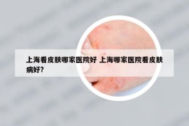 上海看皮肤哪家医院好 上海哪家医院看皮肤病好?