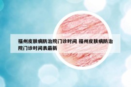 福州皮肤病防治院门诊时间 福州皮肤病防治院门诊时间表最新