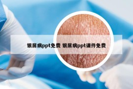 银屑病ppt免费 银屑病ppt课件免费