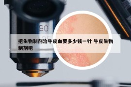 把生物制剂治牛皮血要多少钱一针 牛皮生物制剂吧