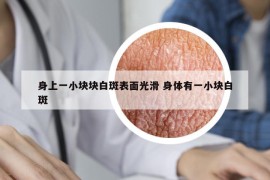 身上一小块块白斑表面光滑 身体有一小块白斑