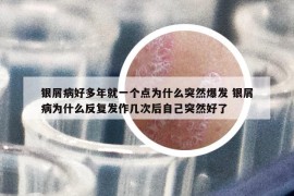 银屑病好多年就一个点为什么突然爆发 银屑病为什么反复发作几次后自己突然好了