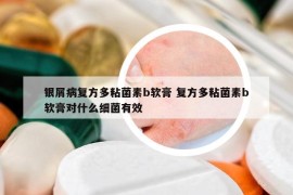 银屑病复方多粘菌素b软膏 复方多粘菌素b软膏对什么细菌有效