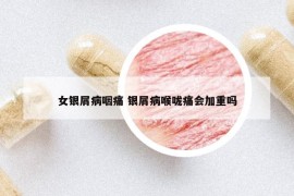 女银屑病咽痛 银屑病喉咙痛会加重吗