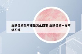 皮肤像癣但不庠是怎么回事 皮肤像癣一样不痛不痒