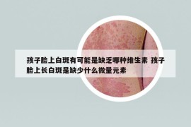 孩子脸上白斑有可能是缺乏哪种维生素 孩子脸上长白斑是缺少什么微量元素