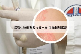 拓咨生物制剂多少钱一支 生物制剂拓姿