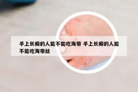 手上长癣的人能不能吃海带 手上长癣的人能不能吃海带丝