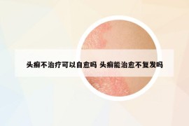 头癣不治疗可以自愈吗 头癣能治愈不复发吗