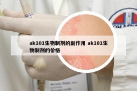 ak101生物制剂的副作用 ak101生物制剂的价格