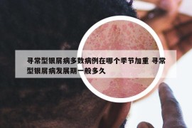 寻常型银屑病多数病例在哪个季节加重 寻常型银屑病发展期一般多久