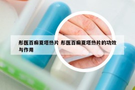 彤医百癣夏塔热片 彤医百癣夏塔热片的功效与作用