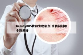 hemay005片和生物制剂 生物制剂哪个效果好