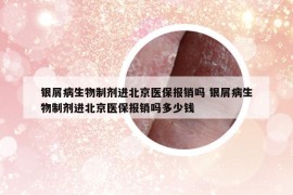 银屑病生物制剂进北京医保报销吗 银屑病生物制剂进北京医保报销吗多少钱